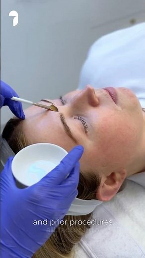 Part 2 - What Type Of Chemical Peel Is Right for Your Skin?