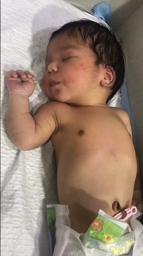 Adorable Moment: Baby Laughs in His Sleep | Dr. Suliman Shah Explains"