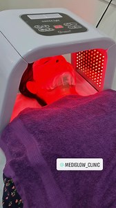 21 reactions | Omega light therapy is a medical grade treatment that improves skin conditions such as acne, acne scars, pigmentation, dull skin and sensitive skin. Mediglow clinic 9310500067 | mediglow_clinic | Facebook