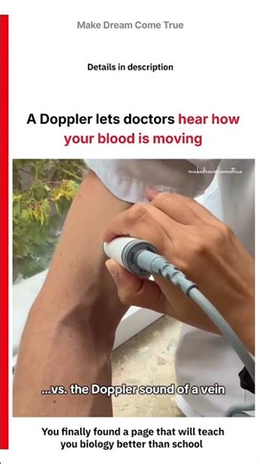 🔊 A Doppler lets doctors 🩸 hear how your blood is moving 🩺 | MDCT