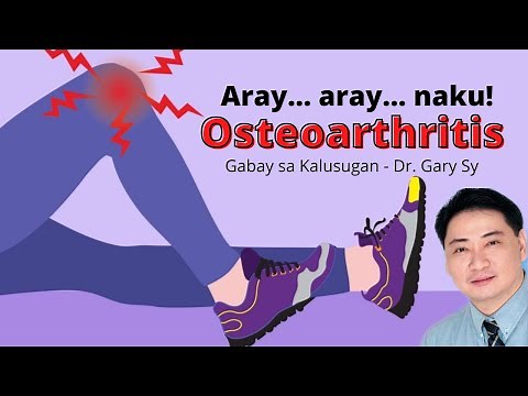 Osteoarthritis - Dr. Gary Sy