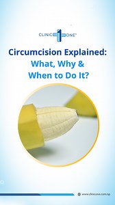 What is circumcision, and why do people get circumcised? Circumcision is a simple procedure that removes the tight foreskin, often recommended when it causes pain, infection, or difficulty cleaning. You might wonder, how do you fix a tight foreskin, or what does circumcision do to a man? It can help improve hygiene, reduce infections, and prevent future complications. It also reduces the risk of penile cancer, HIV, UTI, and other STIs. Wondering what circumcision does to a man or what age is bes