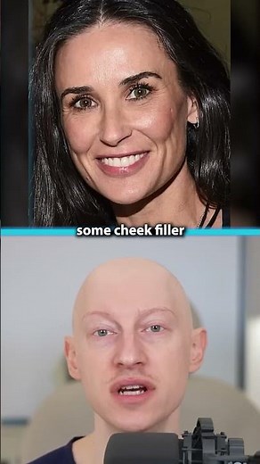 Demi Moore's NEW FACE | Plastic Surgery Analysis
