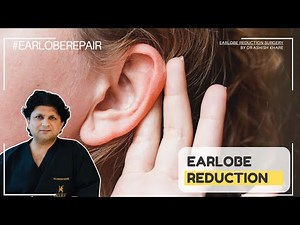 Earlobe Reduction Surgery - Complete Procedure, Before & After Results Board Certified Surgeon