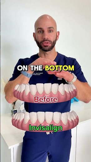 Invisalign for Lower Teeth Straightening