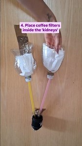 Let’s build a working kidney model!