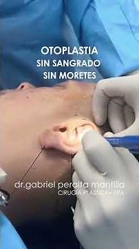 OTOPLASTÍA CIRUGIA DE OREJAS DR GABRIEL PERALTA