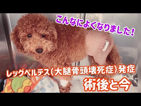 【レッグペルテス・大腿骨頭壊死症を発症】術後と今