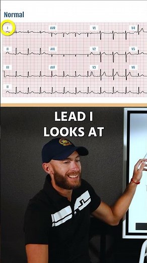 Each EKG Lead = View of Heart