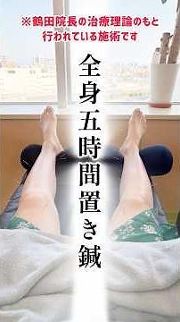 【発症257日目】あの独特な治療法の威力をわからされた #ハント症候群 #顔面神経麻痺 #鍼灸 #病的共同運動 #治療