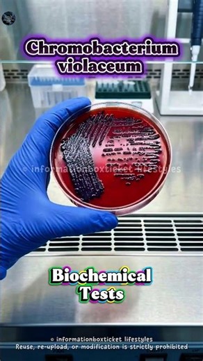 Chromobacterium violaceum Biochemical Tests | Color Changes Made Easy 🔬 #science #biochemicaltests