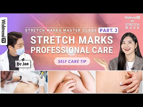 All About Stretch Marks: Asked a Dermatologist and Self Care Tips | Stretch Mark Master Class PART.3
