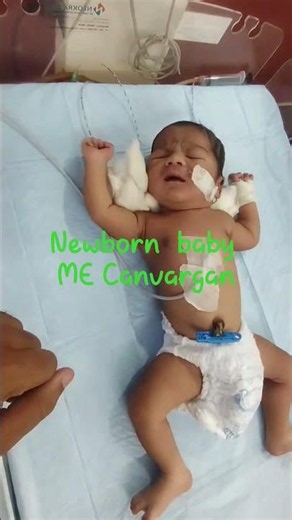 #newbornbaby #hospital #newborn
