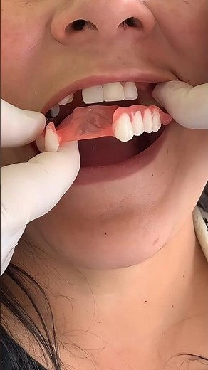 Flexible, suave y muy delgada, está prótesis es la mejor opción !