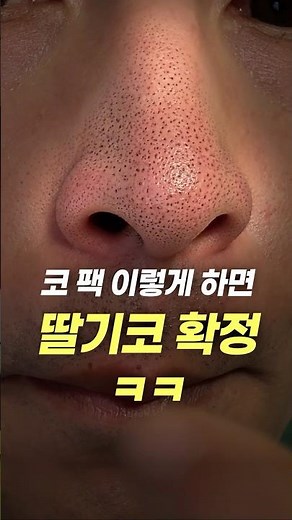 The Ultimate Sebum Removal Tip, More Effective Than Nose Packs (Just Follow Along)