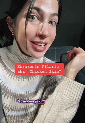 How to get rid of Keratosis Pilaris #ceraveskincare #bumperaser #keratosispilaris