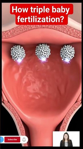 Triple Baby Fertilization | How Triplets Are Formed Inside the Body | 3D Animation #pregnant #baby