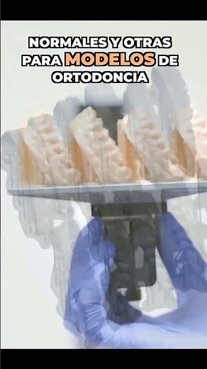 3D Resins for Dentistry: Which One to Choose?