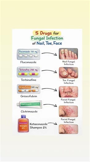 5 Powerful Antifungal Drugs for Nail, Toe & Face Infections 💊