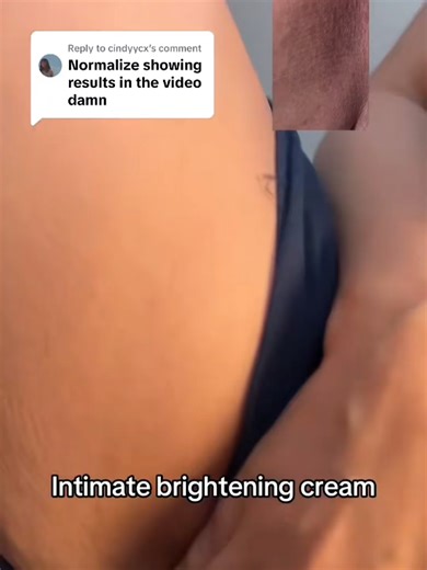 Lighten Intimate Areas: Effective Tips and Products