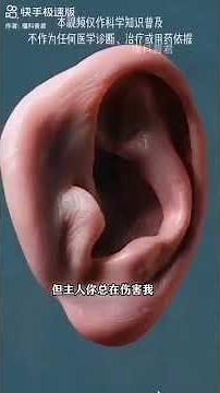 耳朶內部構造及耳膜/半窺管平衡頭暈的原理！影片取自網路:不知創作者、若有侵權敬請告知！