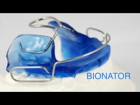 Bionator in Orthodontics Ppt