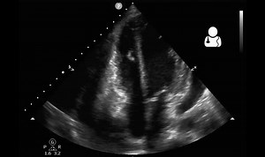 File:Uotw78b (convert-video-online.com).webm - Wikimedia Commons