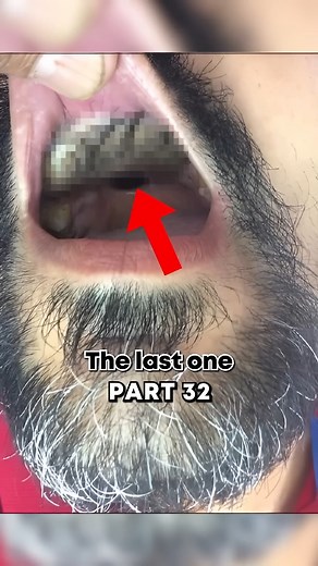 Rare Photos That Will BLOW YOU AWAY 😳 #RarePhotos #VintagePhotography #HiddenGems #HistoricalPhotos #ThrowbackThursday #Nostalgia #PhotoMemories #UnseenMoments #UniqueImages #TimelessBeauty #PhotographyLovers #CollectiblePhotos #MemoryLane #ArtisticPhotography #OldButGold #UnexploredHistory #CandidShots #RareCollections #FlashbackFriday #PhotographyAddict | RareFrames