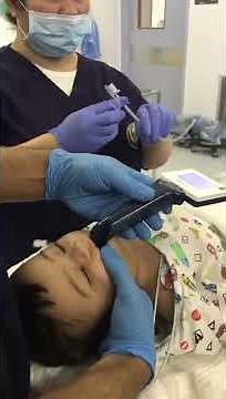 Video laryngoscopy intubation for Pediatrics