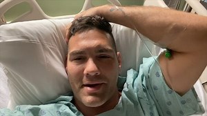 UFC's Chris Weidman Has 'Successful Surgery' On Broken Leg, Can't Walk For 8 Weeks
