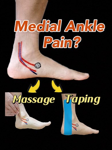 Medial Foot Pain Relief Techniques for Ankle Sprains