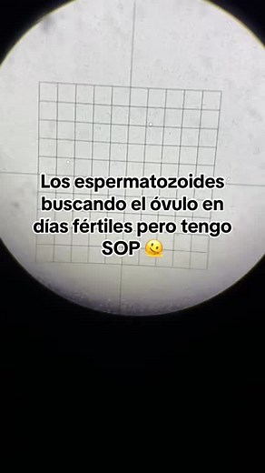 Las pacientes con SOP si se pueden embarazar… pero se pueden tardar más en lograrlo aunque hay algunas q al primer mes les sale bien 😊☝🏻 #SOP #sindromedeovariopoliquistico #infertilidad #embarazo