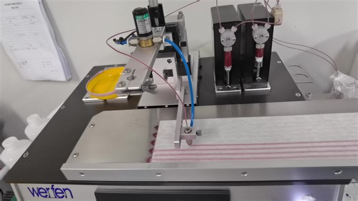 Feline Infectious Peritonitis Antigen Rapid Test Kit FIP FIPV Ag Fast Diagnostic Kit with High Sensitivity for Feline