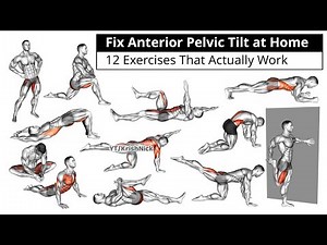 Fix Anterior Pelvic Tilt at Home | 12 Exercises That Actually Work