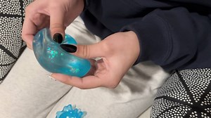 Squishy gel inside fidget toys popular among kids could give skin chemical burns, experts warn
