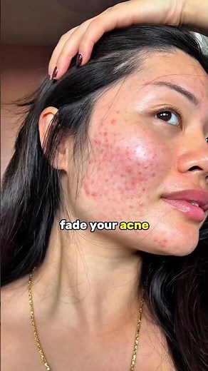 Try This DIY Mask for Brighter, Glowing Skin ✨