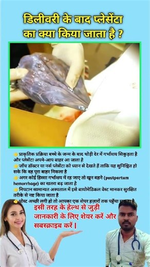 What is done with the placenta after delivery? Placenta removal techniques || #viral #placenta