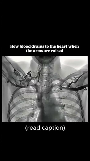 How blood flows to the heat when you lift your arms #science #cool #doctor