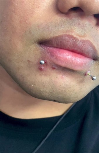 Side Labret Piercing Near NBI & Capitol Lagoon