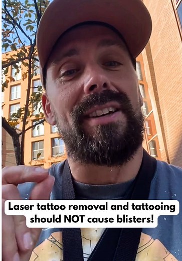 Choosing Safe Tattoo and Laser Treatment Specialists