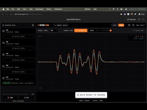 OpenEMG: Photoshop for Biosignals