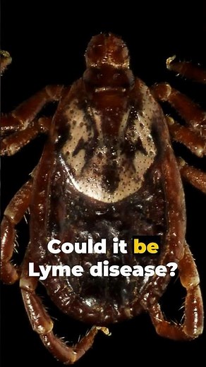 Dealing with a tick bite (what to do)