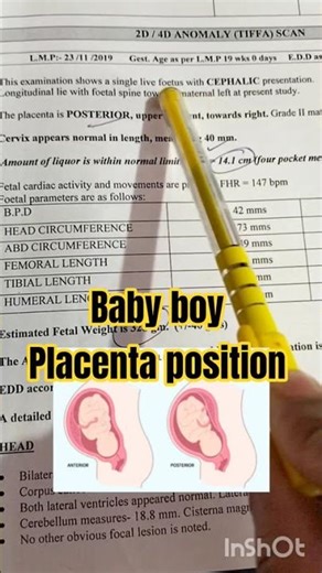 my baby boy placenta position #ultrasound