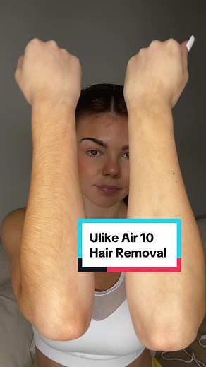 Ulike Air 10 Hair Removal: Does It Work? My Honest Review