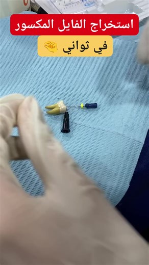 Mohammed Alaref on Instagram: "(The Modified Tube Technique) for broken #files uses a specialized micro-cannula (like a modified #needle or kit extractor) that fits over the visible part of the #fractured file, often with added adhesive (like cyanoacrylate or #composite) or a mechanical wedge, to create a strong grip for retrieval, often combined with #ultrasonics to loosen the file, preserving tooth structure while #removing the fragment. It's a popular, successful method that improves on tradi