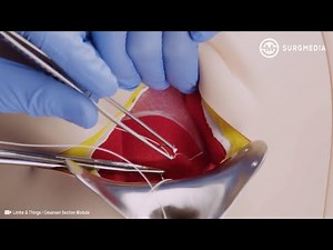 Bringing Simulation to Life: Teaching Surgical Skills in Obstetrics Using a C Section Simulator