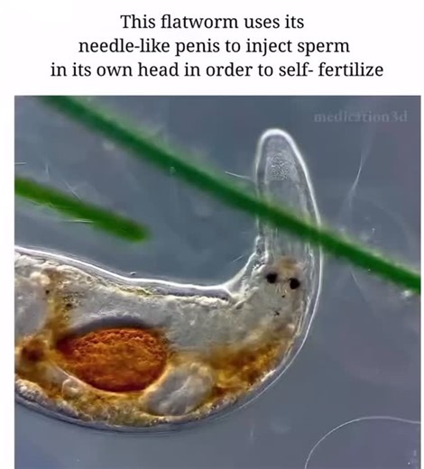 @medico_dna on Instagram: "🦠 Flatworms are hermaphrodites, possessing both male and female reproductive organs. This unique characteristic allows them to self-fertilize, using their needle-like penis to inject sperm into their own body. As a result, they don’t need a mate to reproduce, making them independent in their reproductive cycle. #flatworm #reproduction #medical #biology"