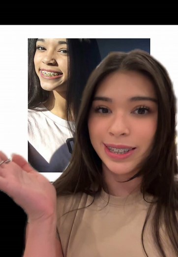 apparently i can’t get braces more than once | aishah braces