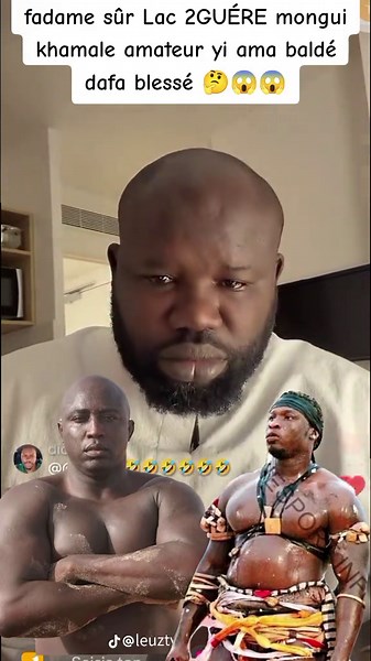 Ama Baldé Blessé à Lac 2GUÉRE : L'Affaire des Amateurs à Mongui