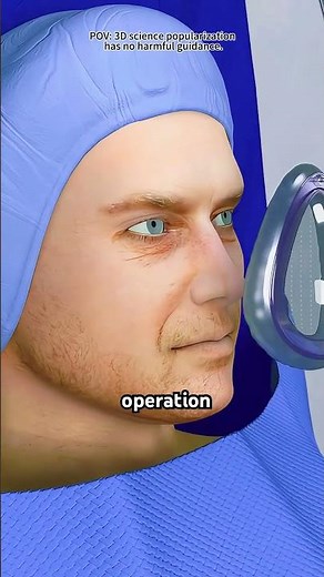 Robot Assisted Prostatectomy Surgery 3D Animation